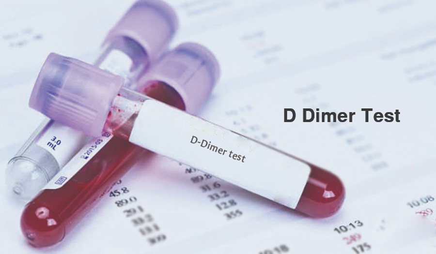 D-Dimer檢測